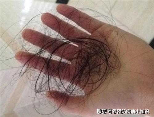 肝脏|37岁小学教师，肝病恶化转移，身体若有这几种表现，别忽视了