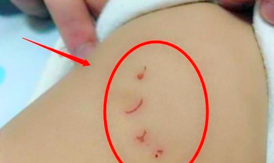 检查|哥哥一“碰”3个月妹妹，妹妹就大哭不已，宝妈检查被褥后痛哭