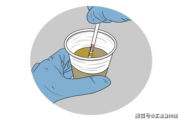 症状|尿毒症，身体知！身体若出现3种“提示”，尽早检查不要拖