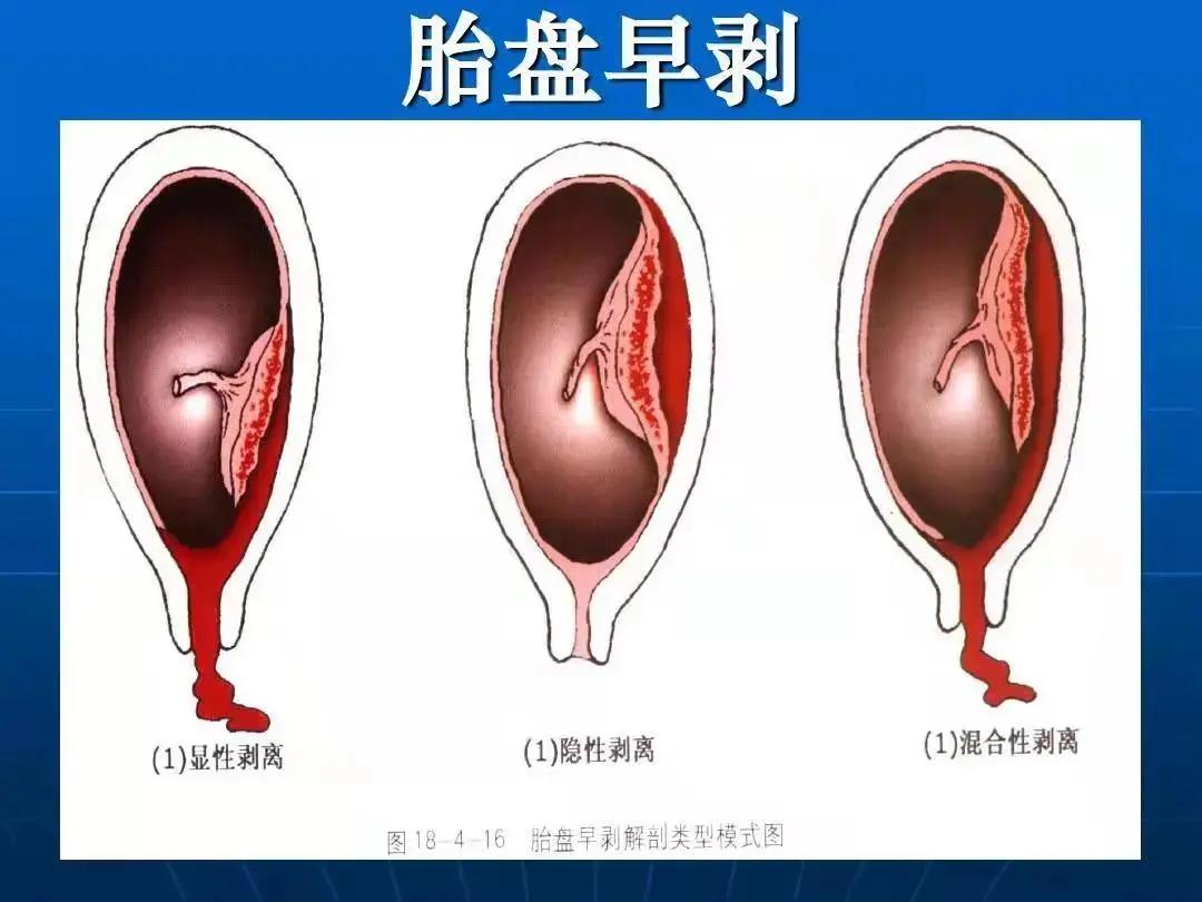 見紅是一點淡血性粘液,宮頸粘液更多,只有少量出血.