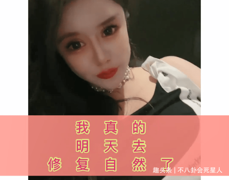 因为00后网红整容成瘾，13岁开整花费百万，整成惊悚脸想选秀出道