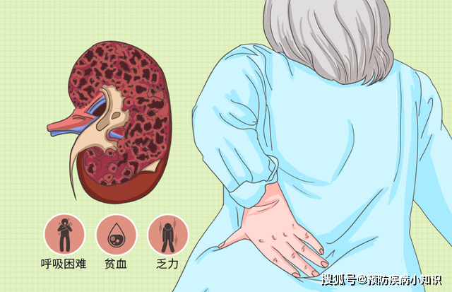 肾脏|40岁男子患尿毒症，依靠透析活命：后悔年轻时太无知，不懂节制