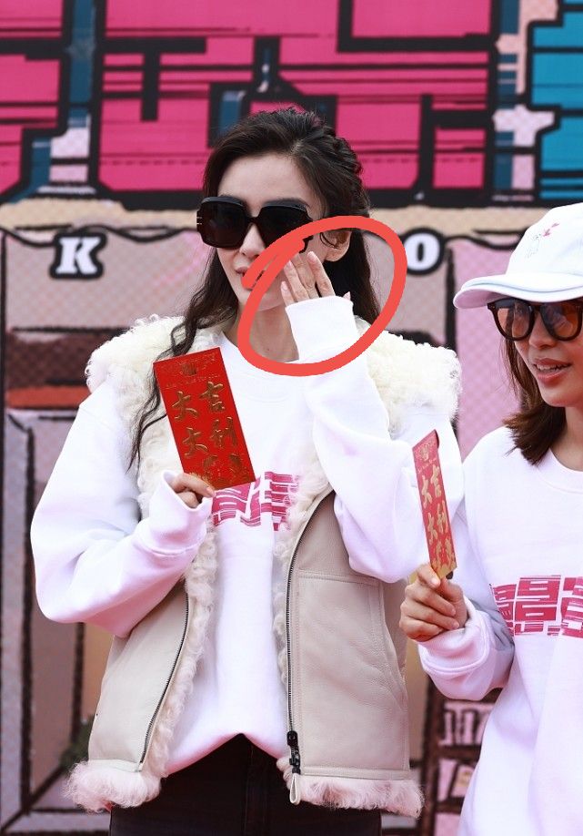 双手 离开滤镜baby颜值也崩了！法令纹瞩目瘦脱相，双手皮肤粗糙似老太