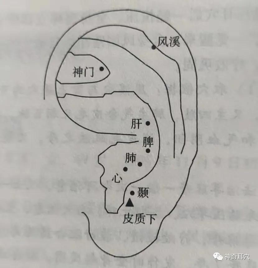 治疗 取耳穴 心