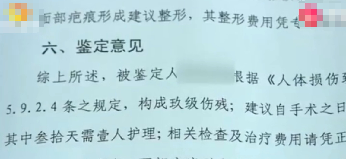 脸部女子做面部填充手术，如今数月不敢出门：老公孩子都不敢看我