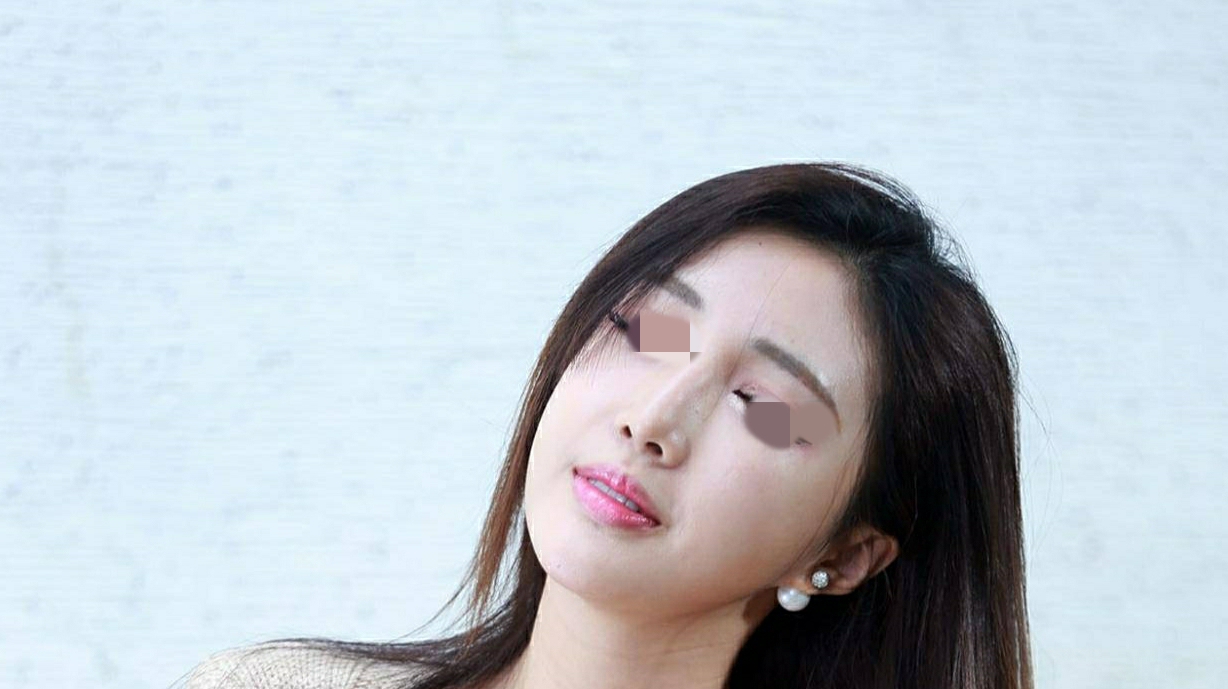 整形为嫁人，女子到医院花58000做整形修复，现在天天以泪洗面不想活