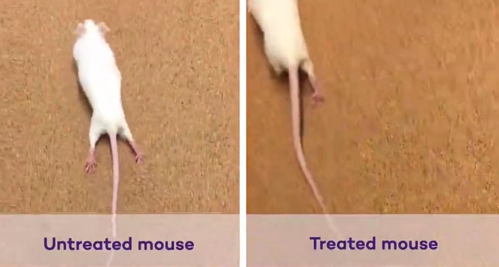 成功|一针逆转瘫痪？美西北大学研发“跳舞”分子，成功修复脊髓损伤