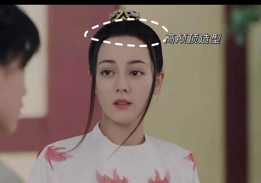 因为容貌焦虑到发疯，用水泥填颅顶！请停止颅顶焦虑