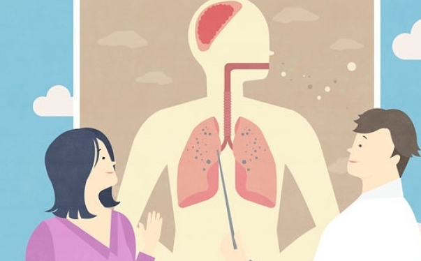 黏液|1亿人已被慢阻肺盯上，通过自测，看看自己是否在其中