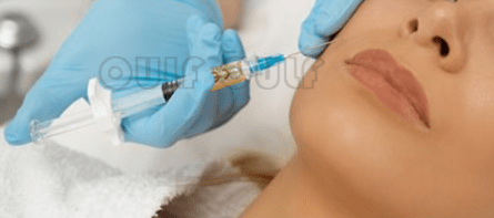 脸部全面还原:脸部脂肪填充恢复过程，全脸脂肪填充5到10天照片~