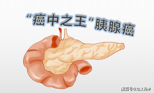 86d4853bcf064b518e7b22e32a5b3504.png