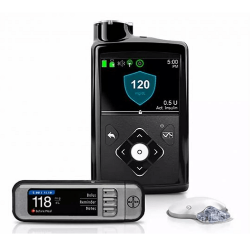 血糖|美敦力胰岛素泵：“人工胰腺”控糖黑科技，为糖友带来巨大的帮助