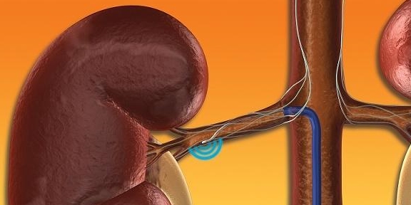 肾是人体最重要的器官吗 224162c47964421ab5e83c2a5cb642ae.jpeg