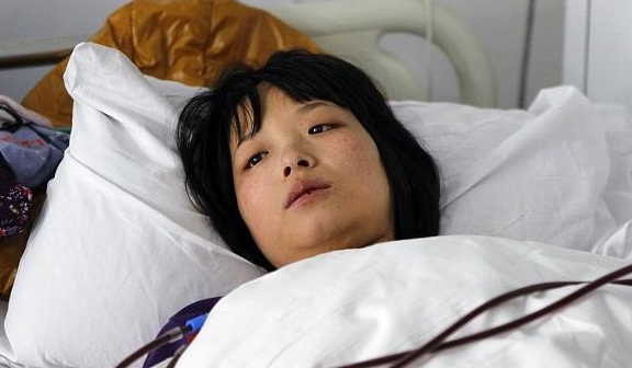 肾脏|健身达人突发“肾衰竭”,这2件事可能是“诱因”,早知道早好