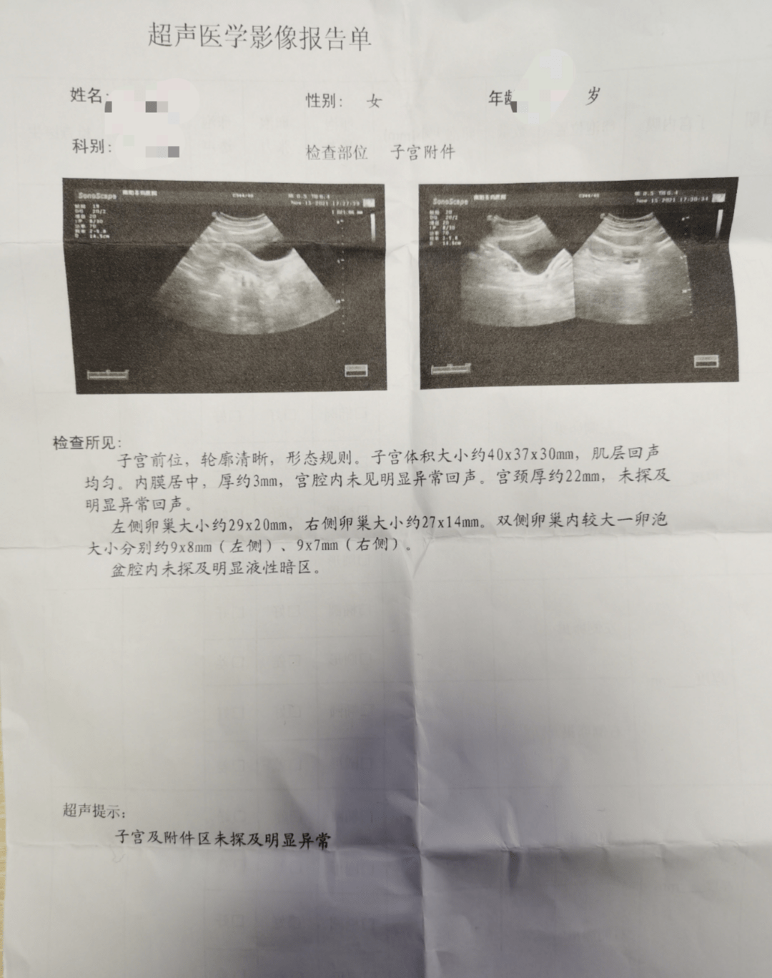 附睾炎超声报告单图片图片