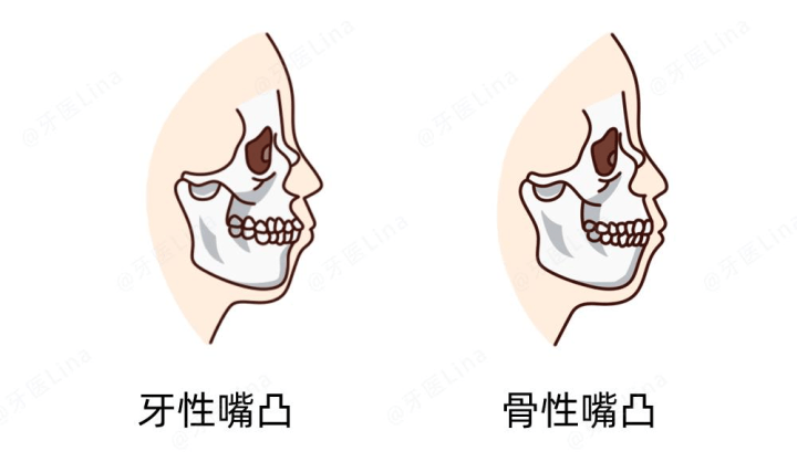 d5e7260b1cb94cf386f0cc9bd6206a14.png