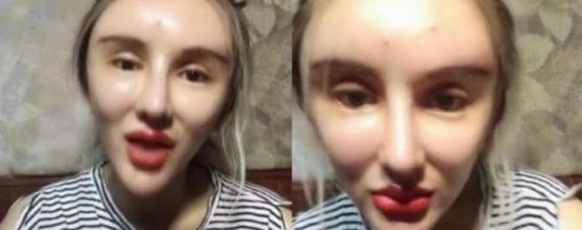 因为女网红沉迷整容却越整越难看，近照嘴巴肿成香肠嘴，承认整容失败