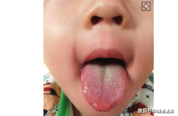 ae74717f429a49e1942596edad984695.jpeg