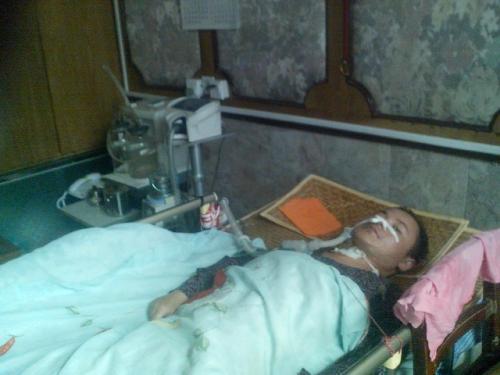 生活|这些因素容易导致运动神经元病继续发展严重