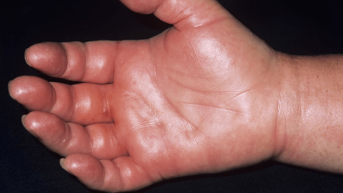 肝脏|肝脏损伤出现5点，常吃1物，好比护肝代谢肝脏的“解忧草”