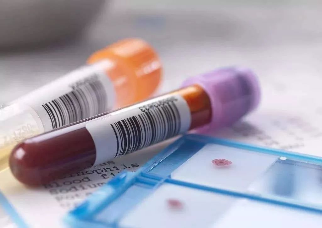 转氨酶|体检报告e抗原阳性，转氨酶正常，是乙肝病毒活跃吗？需要治疗吗