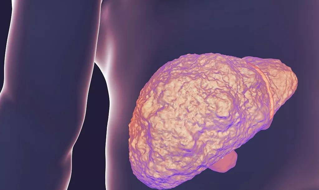 生活|38岁富二代肩膀疼痛，肝病恶化，医生：出现4种不适，建议早查肝