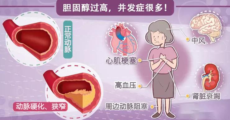 总胆固醇625高不高