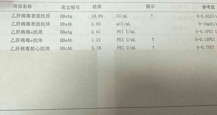 刘庆|婚检乙肝五项，hbsag阳性是什么意思，得了乙肝吗，能领证结婚吗