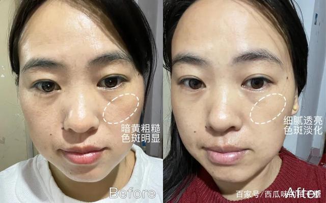口碑美白淡斑产品哪个牌子效果好？祛斑口碑最好十大排名这两个不可少