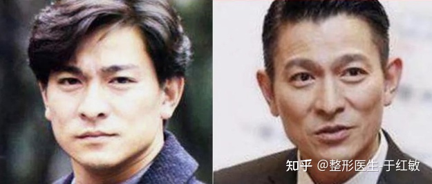 因为法令纹科普大全，一文读懂法令纹！