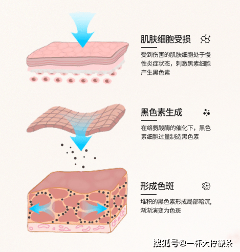 人体天天油烟皮肤不好？小心变黄脸婆！小心机的女人都在用3个小诀窍保持肌肤嫩白