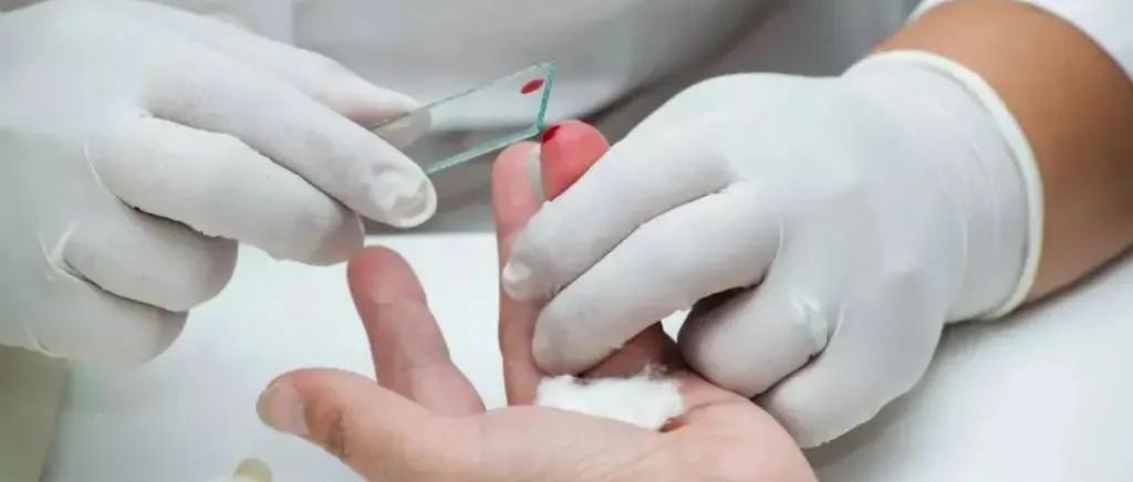 科普|明医科普丨不看不知道，原来采血有这么多门道