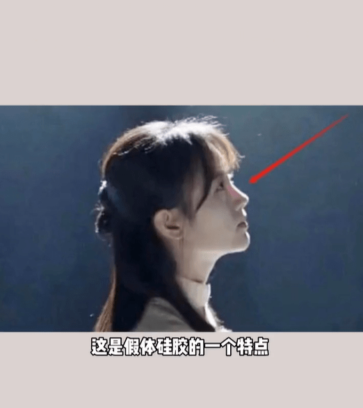分析鞠婧祎被质疑整容！医美博主称其是硅胶隆鼻填充脂肪最成功案例