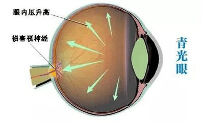 0a8935d2d8d84978b897c7c4dea3f40e.png