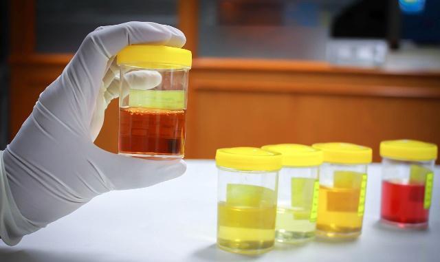 出现泡沫|别让高血糖伤了你的肾！出现这几个信号，千万要警惕！