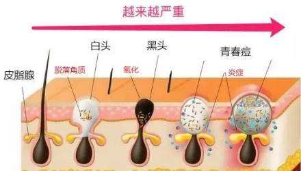 毛囊“换季就变丑”？容貌焦虑的我有多难，你知道吗~