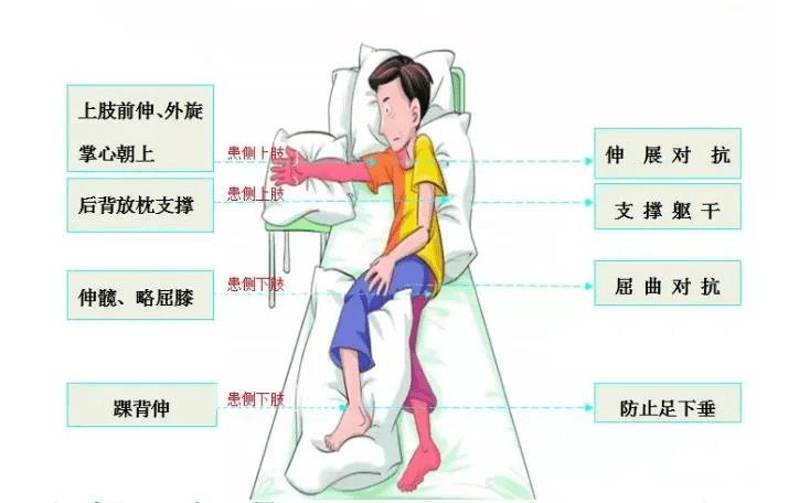 图解脑卒中患者康复训练法这样做好的快在家也能轻松完成