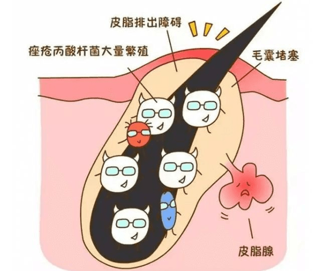 毛囊“换季就变丑”？容貌焦虑的我有多难，你知道吗~