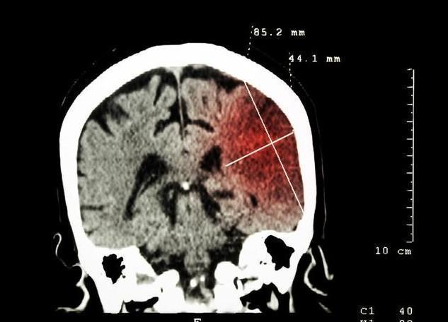 男女|无论男女,45岁以后,早起有4个习惯,就能健康少生病
