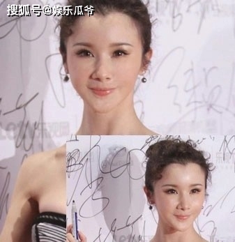 后遗症这些同龄女星都曾是绝世美人，有人整容后遗症像妖怪，有人美到老