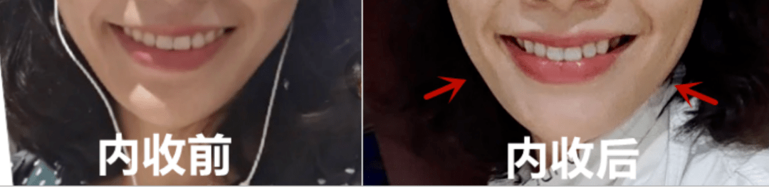 对比今天的吴宣仪，美到路过的蚂蚁都在夸：搞得值！