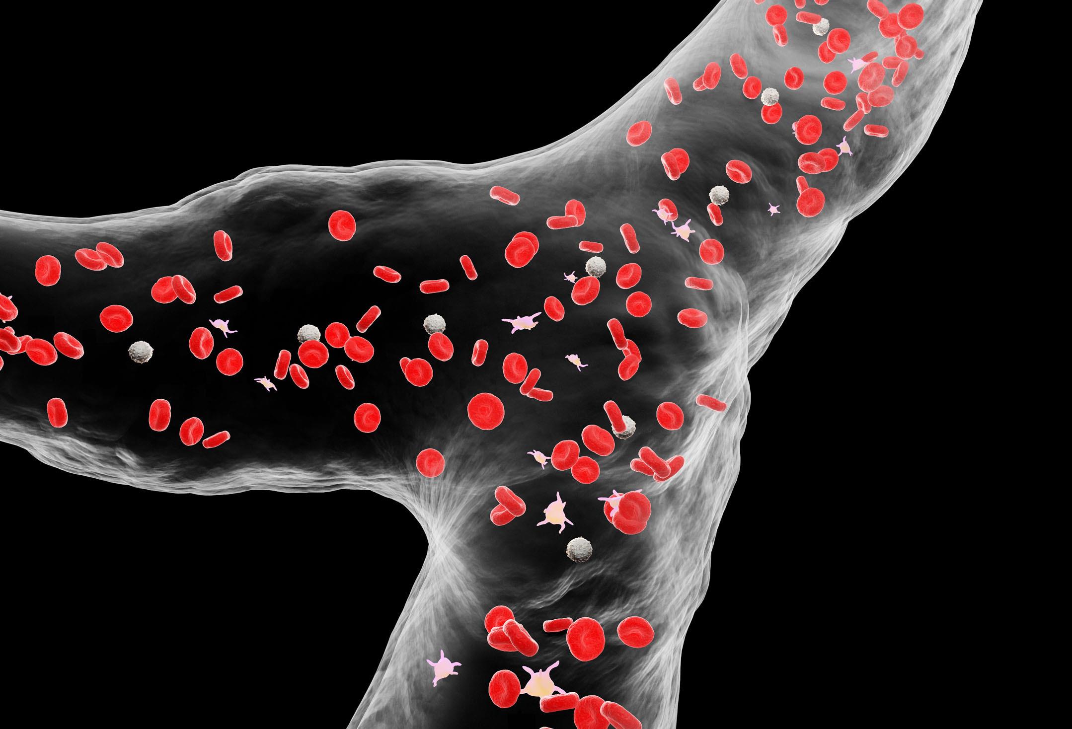 肾脏|得了肾病,为什么身体会水肿得厉害?原因逐个分析