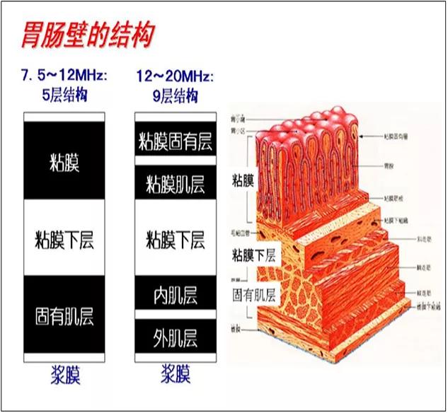 检查|促进学科高质量发展——西安市第一医院消化内科首次开展超声内镜检查术