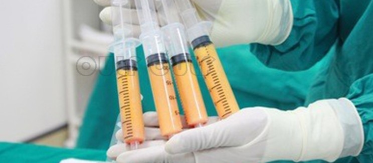 三个阶段脂肪填充一次可以成功吗?脂肪填充图片效果好,来看看