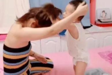 毛囊发际线对颜值的影响有多大?20岁的小姐姐秒变50岁的老阿姨…