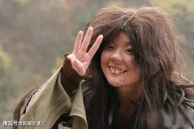 宋轶凸嘴无法修复的四种迹象，千万别中招