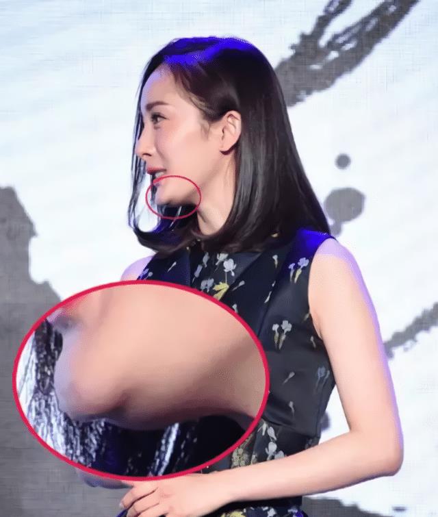 变化那些削骨“一刀切”的明星还好吗？有的已垮掉，小方脸成最后赢家
