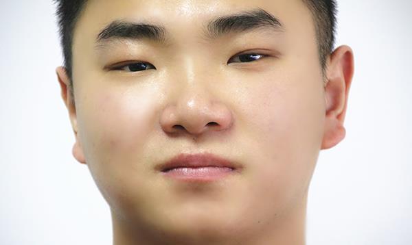 眼睛|肝不好的人,有什么症状?医生:养成4个小习惯,让肝更健康