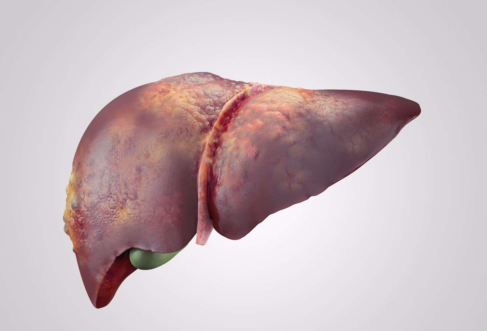 肝肾|肝肾不好?晨起的这3个习惯行为,很多人天天在做