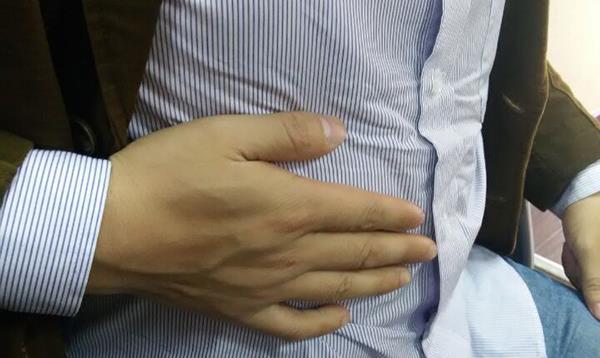 生活|肝脏不好，先上脸！脸上有4个变化，预示肝病上身，尽早查肝功能